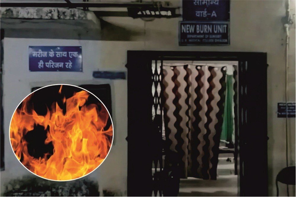 ग्वालियर में ₹250 के विवाद में युवक को पेट्रोल डालकर जलाया, दो आरोपी गिरफ्तार